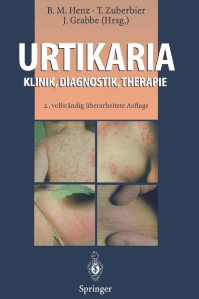 Urtikaria: Klinik, Diagnostik, Therapie