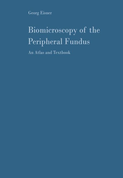 Biomicroscopy of the Peripheral Fundus: An Atlas and Textbook / Edition 1