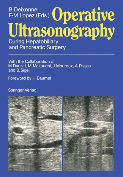 Operative Ultrasonography: During Hepatobiliary and Pancreatic Surgery / Edition 1