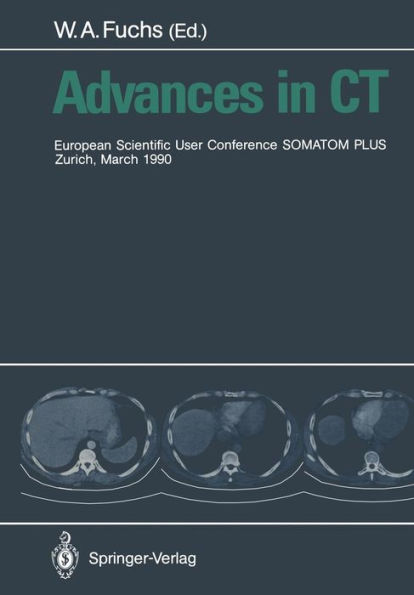 Advances in CT: European Scientific User Conference SOMATOM PLUS Zurich, March 1990 / Edition 1