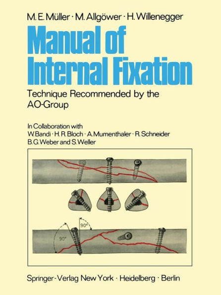 Manual of Internal Fixation: Technique Recommended by the AO-Group Swiss Association for the Study of Internal Fixation: ASIF / Edition 1