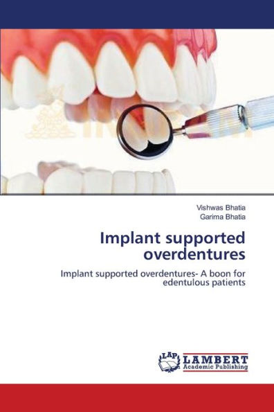 Implant supported overdentures