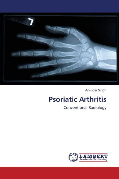 Psoriatic Arthritis