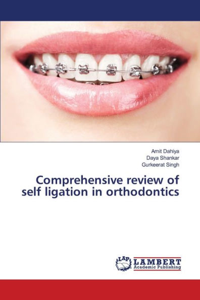 Comprehensive review of self ligation in orthodontics