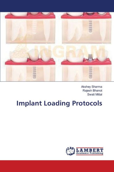 Implant Loading Protocols