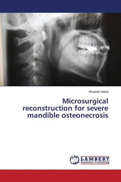 Microsurgical reconstruction for severe mandible osteonecrosis