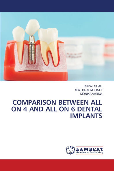Comparison Between All on 4 and All on 6 Dental Implants