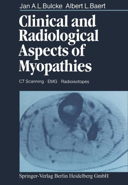 Clinical and Radiological Aspects of Myopathies: CT Scanning ï¿½ EMG ï¿½ Radioisotopes