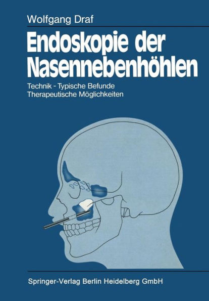 Endoskopie der Nasennebenhï¿½hlen: Technik ï¿½ Typische Befunde, Therapeutische Mï¿½glichkeiten