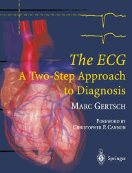 Title: The ECG: A Two-Step Approach to Diagnosis, Author: Marc Gertsch