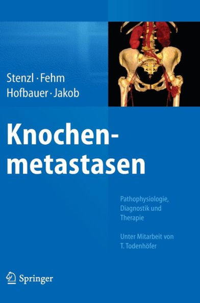 Knochenmetastasen: Pathophysiologie, Diagnostik und Therapie - Unter Mitarbeit von T. Todenhöfer