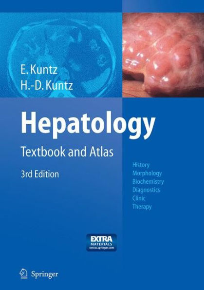 Hepatology: Textbook and Atlas / Edition 3