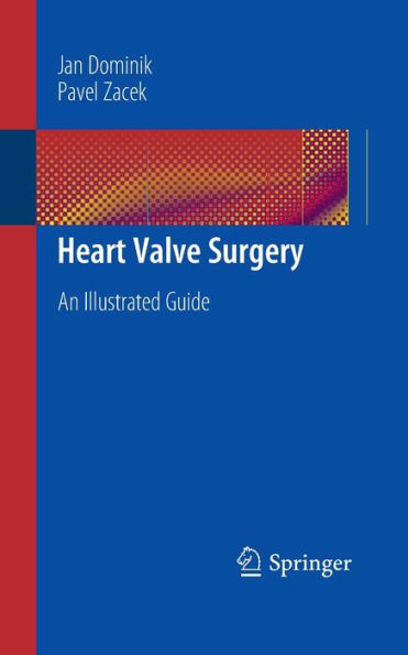 Heart Valve Surgery: An Illustrated Guide