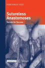 Sutureless Anastomoses: Secrets for Success