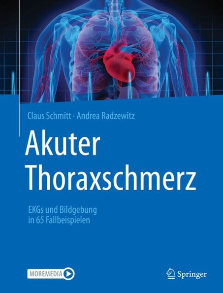 Akuter Thoraxschmerz: EKGs und Bildgebung in 65 Fallbeispielen
