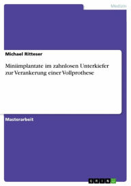 Title: Miniimplantate im zahnlosen Unterkiefer zur Verankerung einer Vollprothese, Author: Michael Ritteser