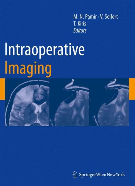 Intraoperative Imaging / Edition 1