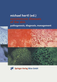 Title: Autoimmune Diseases of the Skin: Pathogenesis, Diagnosis, Management, Author: Michael Hertl