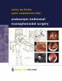 Endoscopic Endonasal Transsphenoidal Surgery