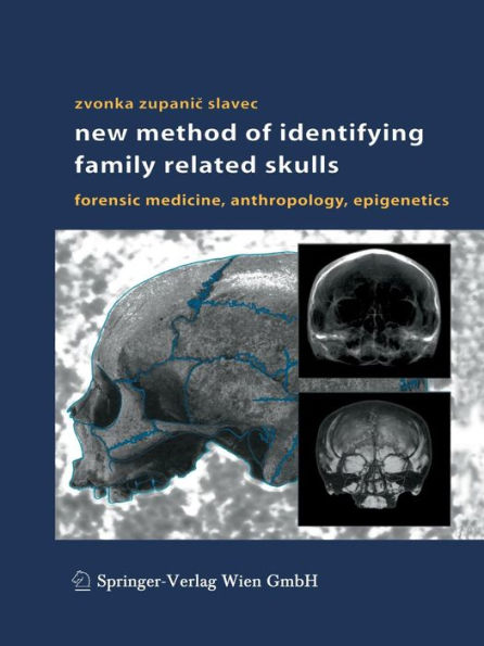 New Method of Identifying Family Related Skulls: Forensic Medicine, Anthropology, Epigenetics / Edition 1