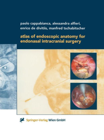 Atlas of Endoscopic Anatomy for Endonasal Intracranial Surgery / Edition 1