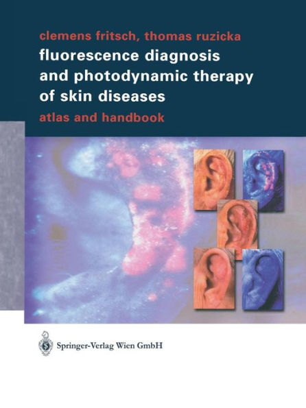 Fluorescence Diagnosis and Photodynamic Therapy of Skin Diseases: Atlas Handbook