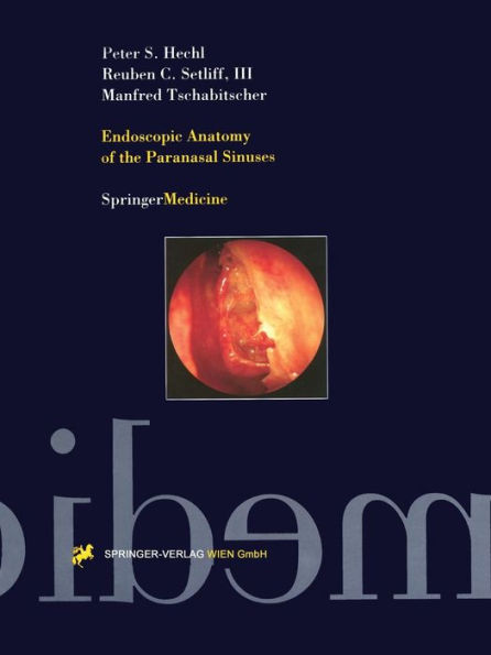 Endoscopic Anatomy of the Paranasal Sinuses / Edition 1