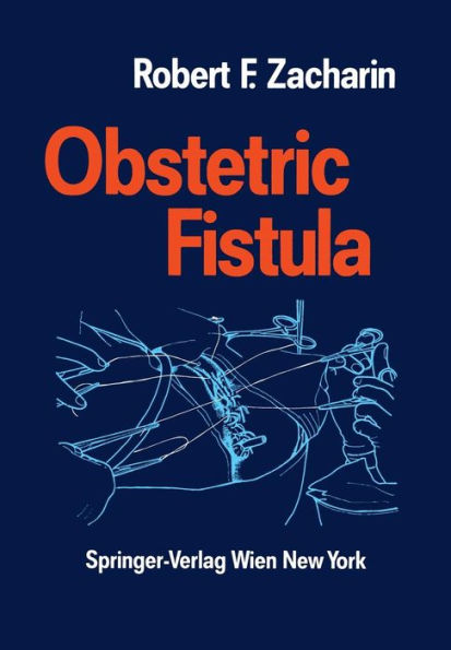 Obstetric Fistula