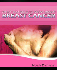 Title: What You Need to Know About Breast Cancer, Author: Noah Daniels