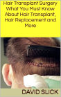 Hair Transplant Surgery: What You Must Know About Hair Transplant, Hair Replacement and More