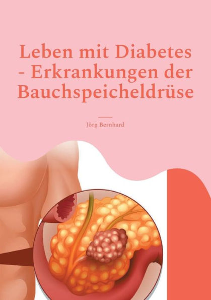 Leben mit Diabetes - Erkrankungen der Bauchspeicheldrï¿½se: Umgang mit Diabetes, Leben ohne Bauchspeichel mï¿½glich, Funktionen des Organes