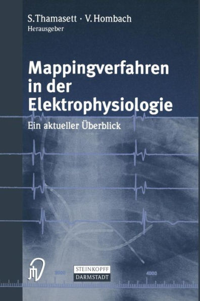 Mappingverfahren in der Elektrophysiologie: Ein aktueller Überblick