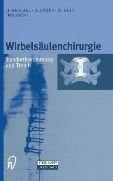 Wirbelsaulenchirurgie: Standortbestimmung und Trends / Edition 1