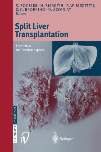 Split liver transplantation: Theoretical and practical aspects