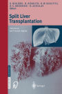 Split liver transplantation: Theoretical and practical aspects