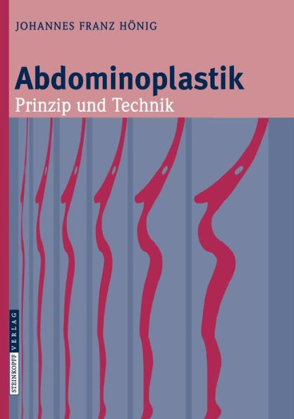 Abdominoplastik: Prinzip und Technik