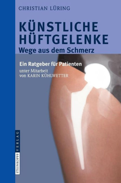 Künstliche Hüftgelenke: Wege aus dem Schmerz / Edition 1