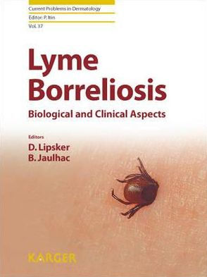 Lyme Borreliosis: Biological and Clinical Aspects