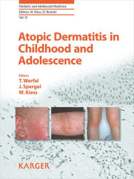 Title: Atopic Dermatitis in Childhood and Adolescence, Author: W. Kiess