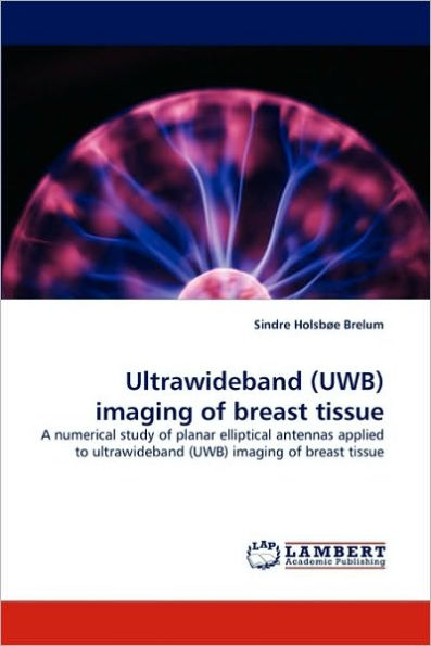 Ultrawideband (Uwb) Imaging of Breast Tissue