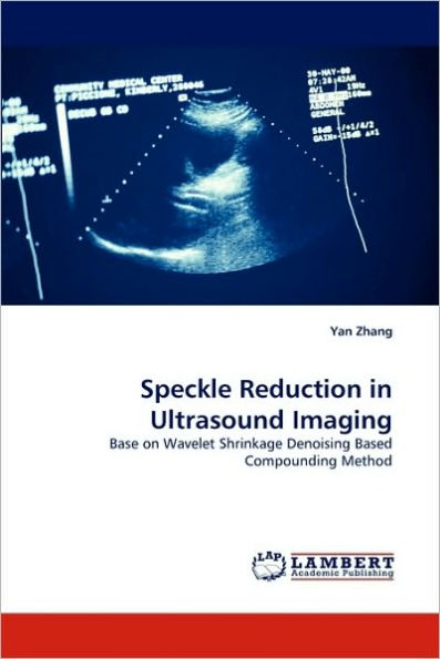 Speckle Reduction in Ultrasound Imaging