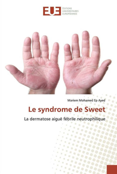 Le syndrome de Sweet