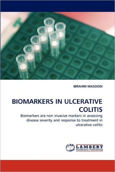 Biomarkers in Ulcerative Colitis