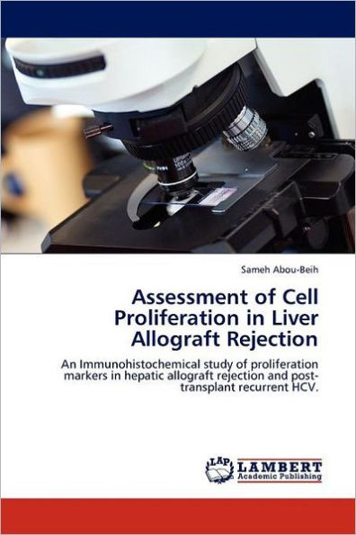 Assessment of Cell Proliferation in Liver Allograft Rejection