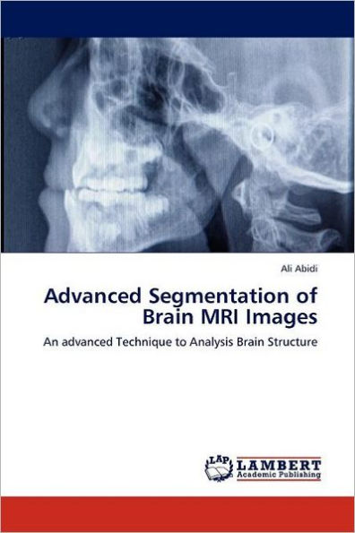 Advanced Segmentation of Brain MRI Images