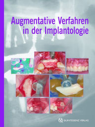 Title: Augmentative Verfahren in der Implantologie, Author: Fouad Khoury