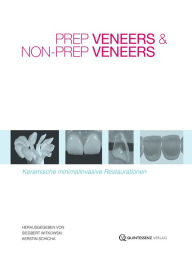 Title: Prep Veneers und Non-Prep Veneers: Keramische minimalinvasive Restaurationen, Author: Siegbert Witkowski