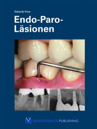 Title: Endo-Paro-Läsionen, Author: Edoardo Foce