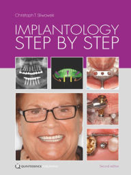 Title: Implantology Step by Step, Author: Christoph T. Sliwowski
