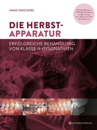 Title: Die Herbst-Apparatur: Erfolgreiche Behandlung von Klasse-II-Dysgnathien, Author: Hans Pancherz